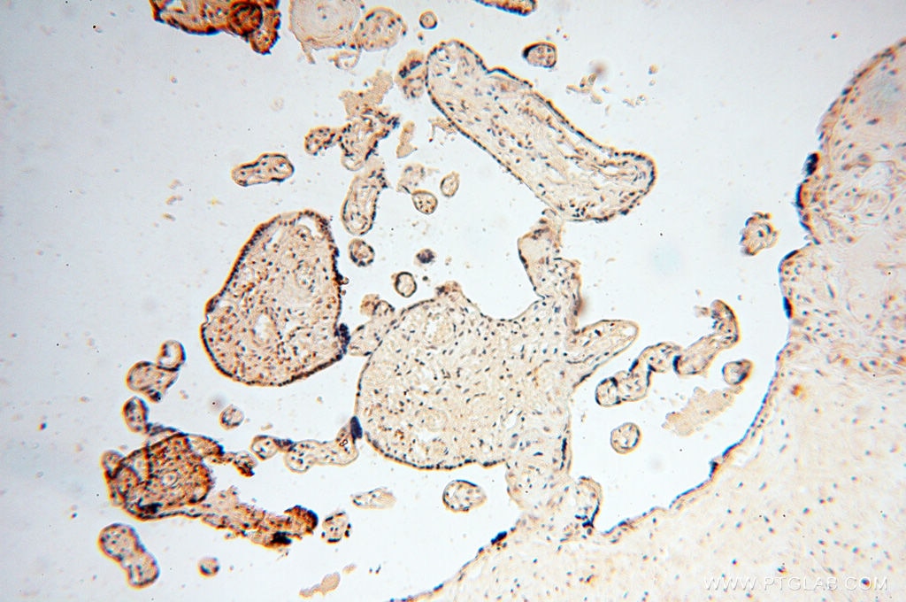 Immunohistochemistry (IHC) staining of human placenta tissue using HIRIP3 Polyclonal antibody (14992-1-AP)