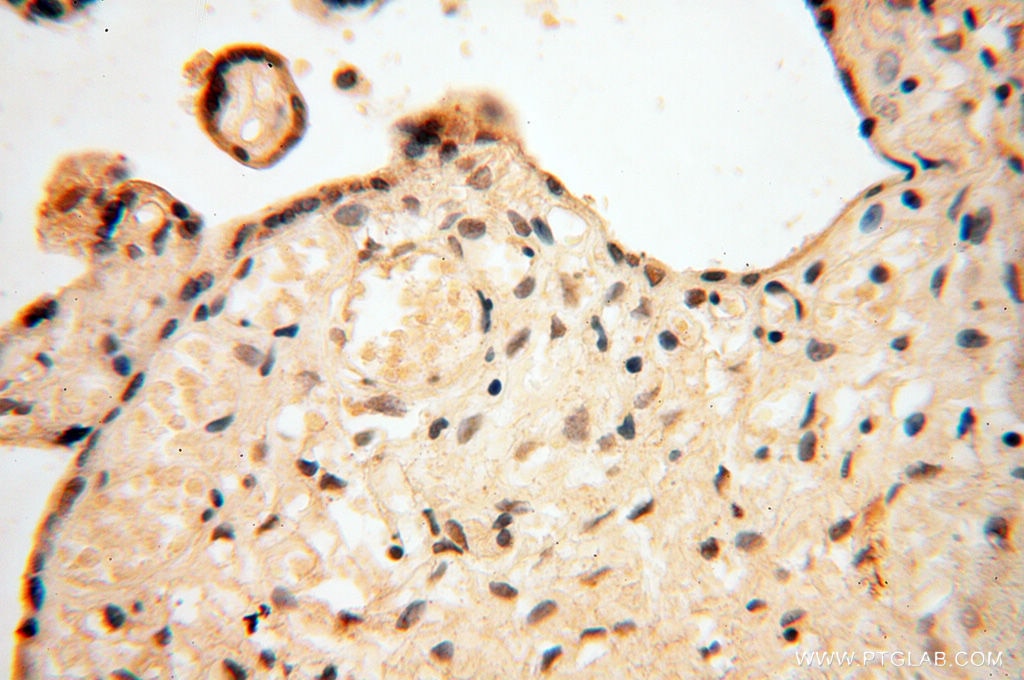 Immunohistochemistry (IHC) staining of human placenta tissue using HIRIP3 Polyclonal antibody (14992-1-AP)