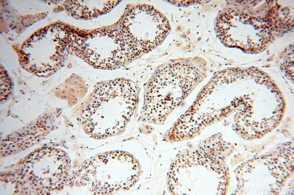 Immunohistochemistry (IHC) staining of human testis tissue using HIRIP3 Polyclonal antibody (14992-1-AP)