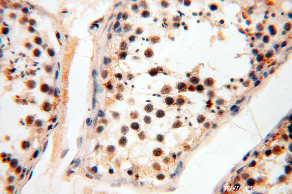 Immunohistochemistry (IHC) staining of human testis tissue using HIRIP3 Polyclonal antibody (14992-1-AP)