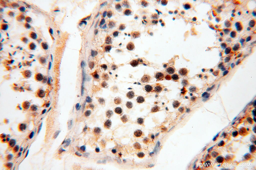 IHC staining of human testis using 14992-1-AP