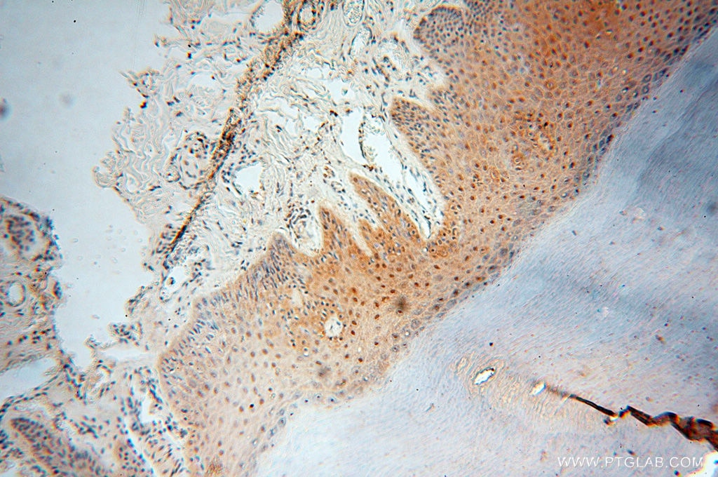 Immunohistochemistry (IHC) staining of human skin tissue using HIRIP3 Polyclonal antibody (14992-1-AP)