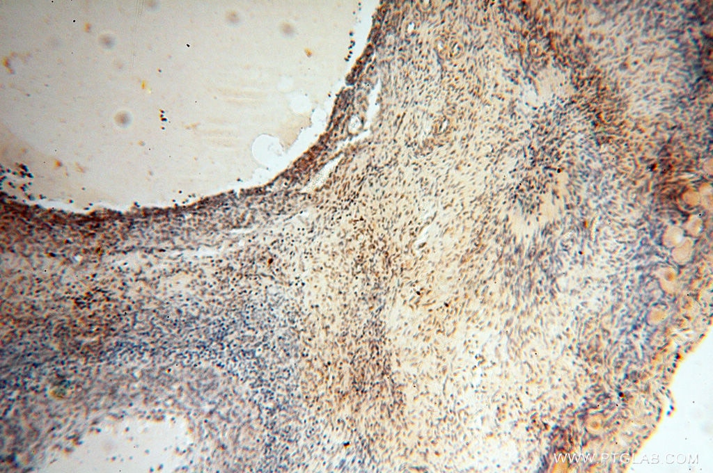 Immunohistochemistry (IHC) staining of human ovary tissue using HIRIP3 Polyclonal antibody (14992-1-AP)