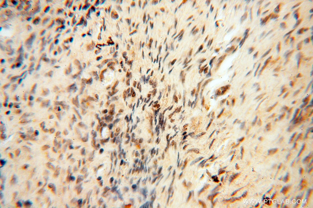 Immunohistochemistry (IHC) staining of human ovary tissue using HIRIP3 Polyclonal antibody (14992-1-AP)