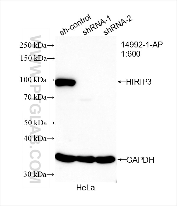 Western Blot (WB) analysis of HeLa cells using HIRIP3 Polyclonal antibody (14992-1-AP)
