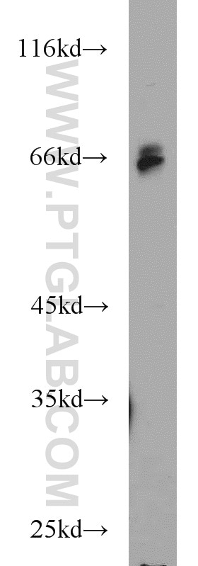 Western Blot (WB) analysis of human heart tissue using HIRIP3 Polyclonal antibody (14992-1-AP)