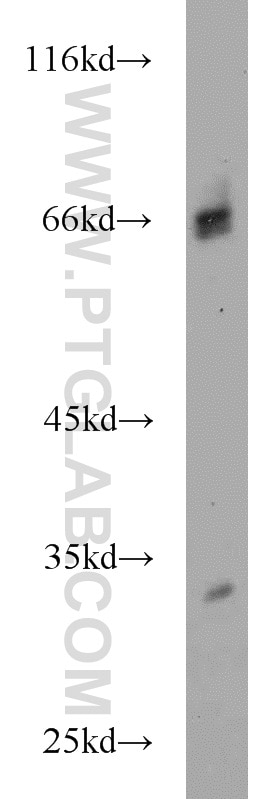 Western Blot (WB) analysis of human skeletal muscle tissue using HIRIP3 Polyclonal antibody (14992-1-AP)