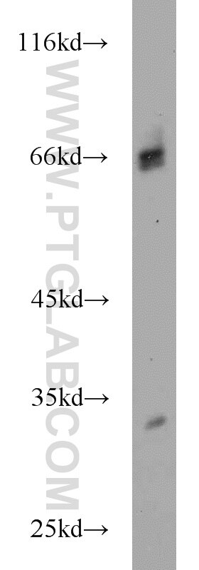 WB analysis of human skeletal muscle using 14992-1-AP