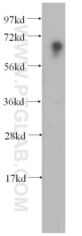 Western Blot (WB) analysis of mouse skeletal muscle tissue using HIRIP3 Polyclonal antibody (14992-1-AP)