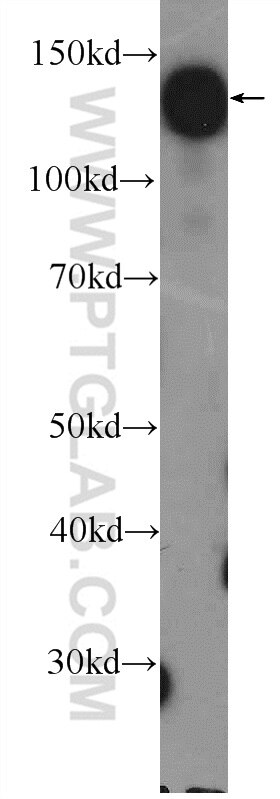 Western Blot (WB) analysis of K-562 cells using HISPPD1 Polyclonal antibody (26018-1-AP)