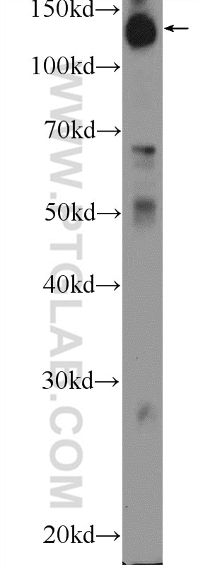Western Blot (WB) analysis of Jurkat cells using HISPPD1 Polyclonal antibody (26018-1-AP)