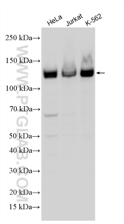 Western Blot (WB) analysis of various lysates using HISPPD1 Polyclonal antibody (26018-1-AP)