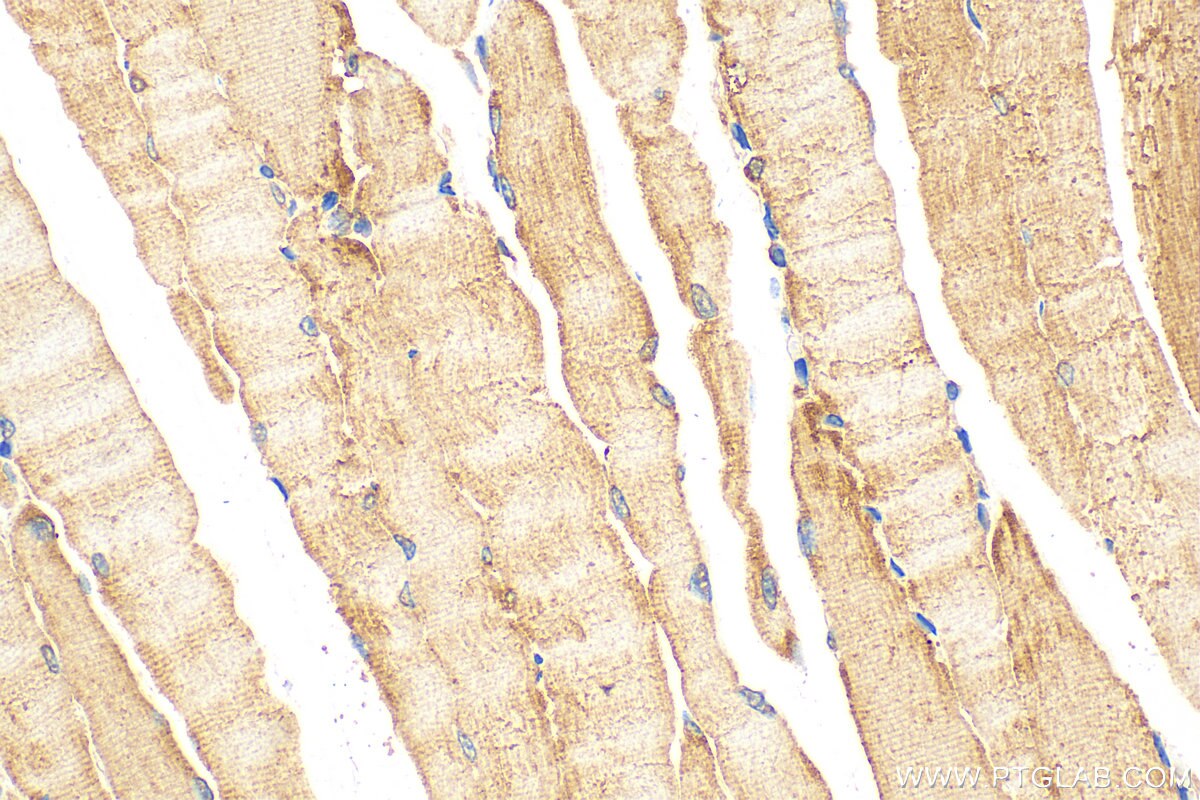 Immunohistochemistry (IHC) staining of mouse skeletal muscle tissue using PPIP5K1 Polyclonal antibody (14331-1-AP)