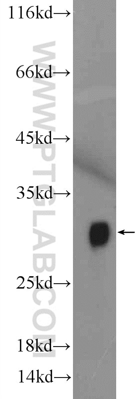Western Blot (WB) analysis of mouse kidney tissue using Histone H1 Polyclonal antibody (18201-1-AP)