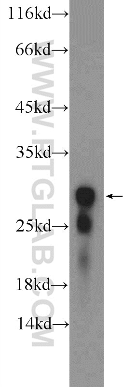 WB analysis of mouse kidney using 18201-1-AP