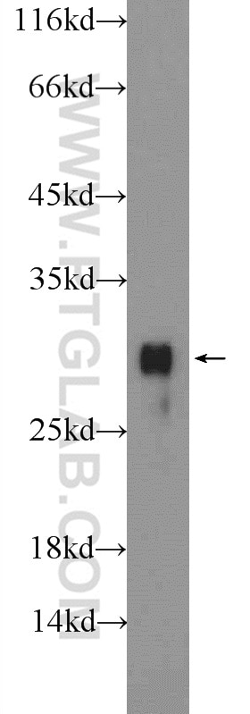 WB analysis of mouse lung using 18201-1-AP