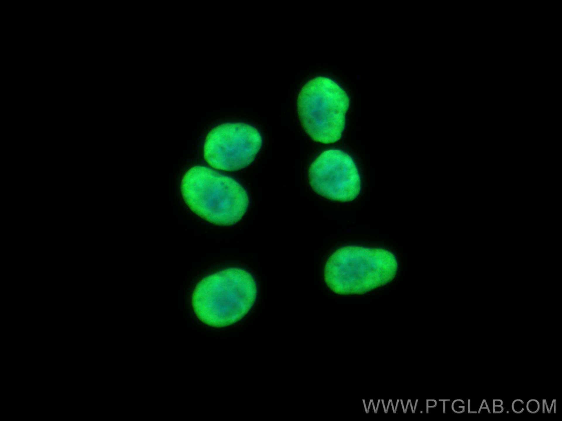 Immunofluorescence (IF) / fluorescent staining of SH-SY5Y cells using HIST1H1B Polyclonal antibody (18093-1-AP)