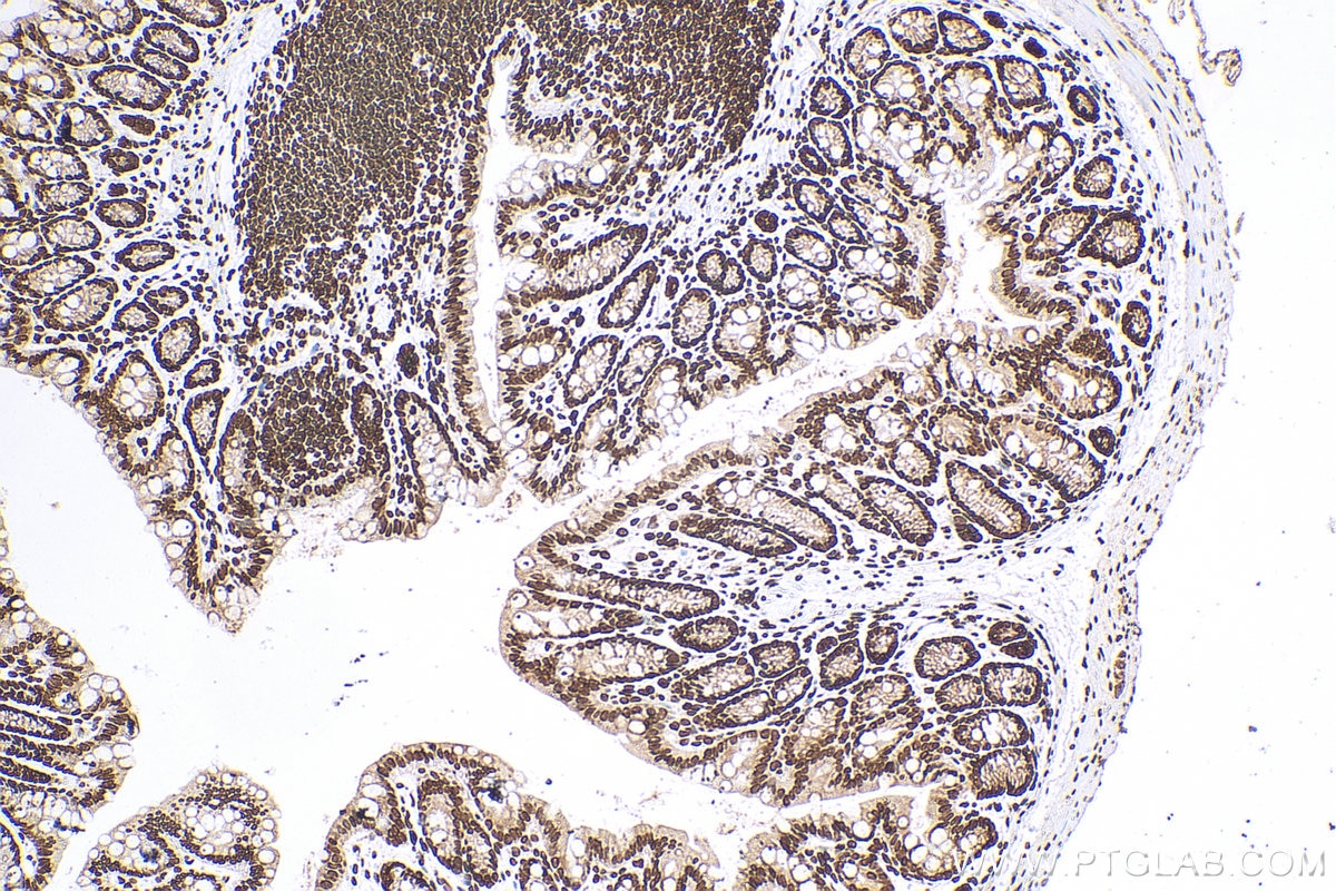 Immunohistochemistry (IHC) staining of mouse colon tissue using HIST1H1B Polyclonal antibody (18093-1-AP)