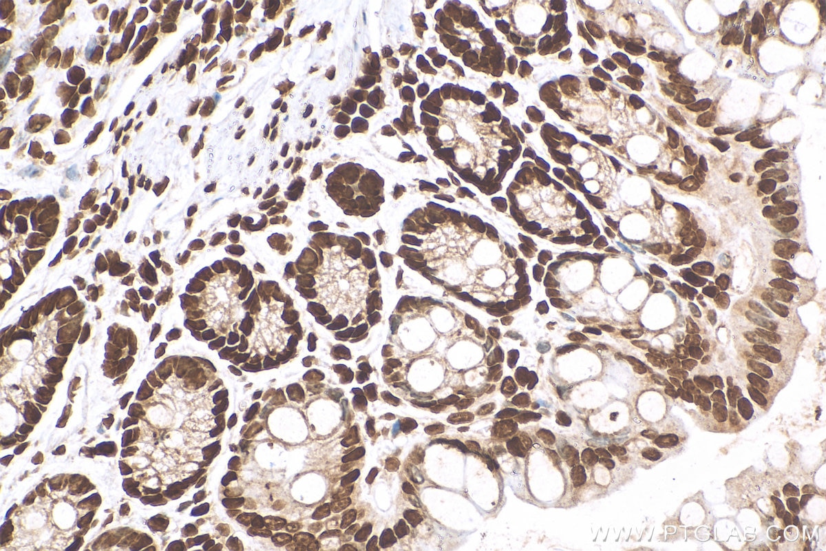 Immunohistochemistry (IHC) staining of mouse colon tissue using HIST1H1B Polyclonal antibody (18093-1-AP)