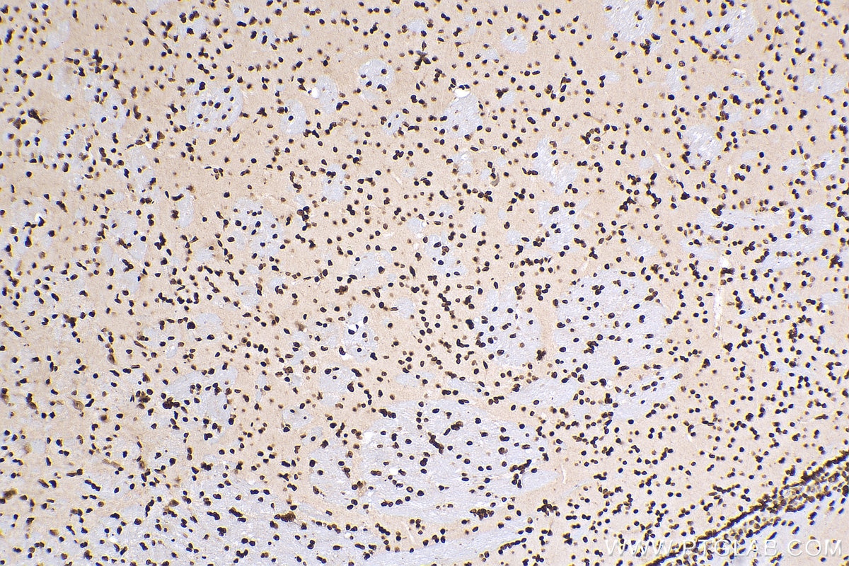 Immunohistochemistry (IHC) staining of mouse brain tissue using HIST1H1B Polyclonal antibody (18093-1-AP)