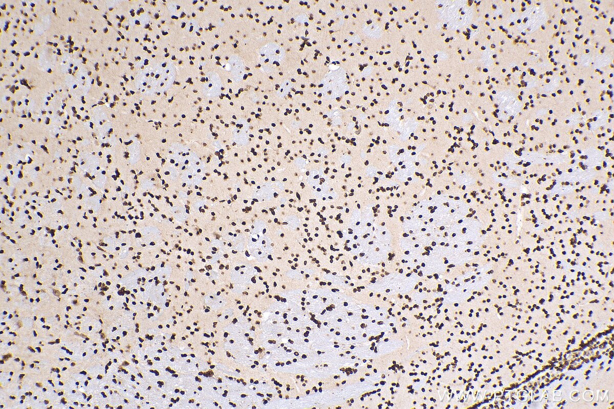 Immunohistochemistry (IHC) staining of mouse brain tissue using HIST1H1B Polyclonal antibody (18093-1-AP)