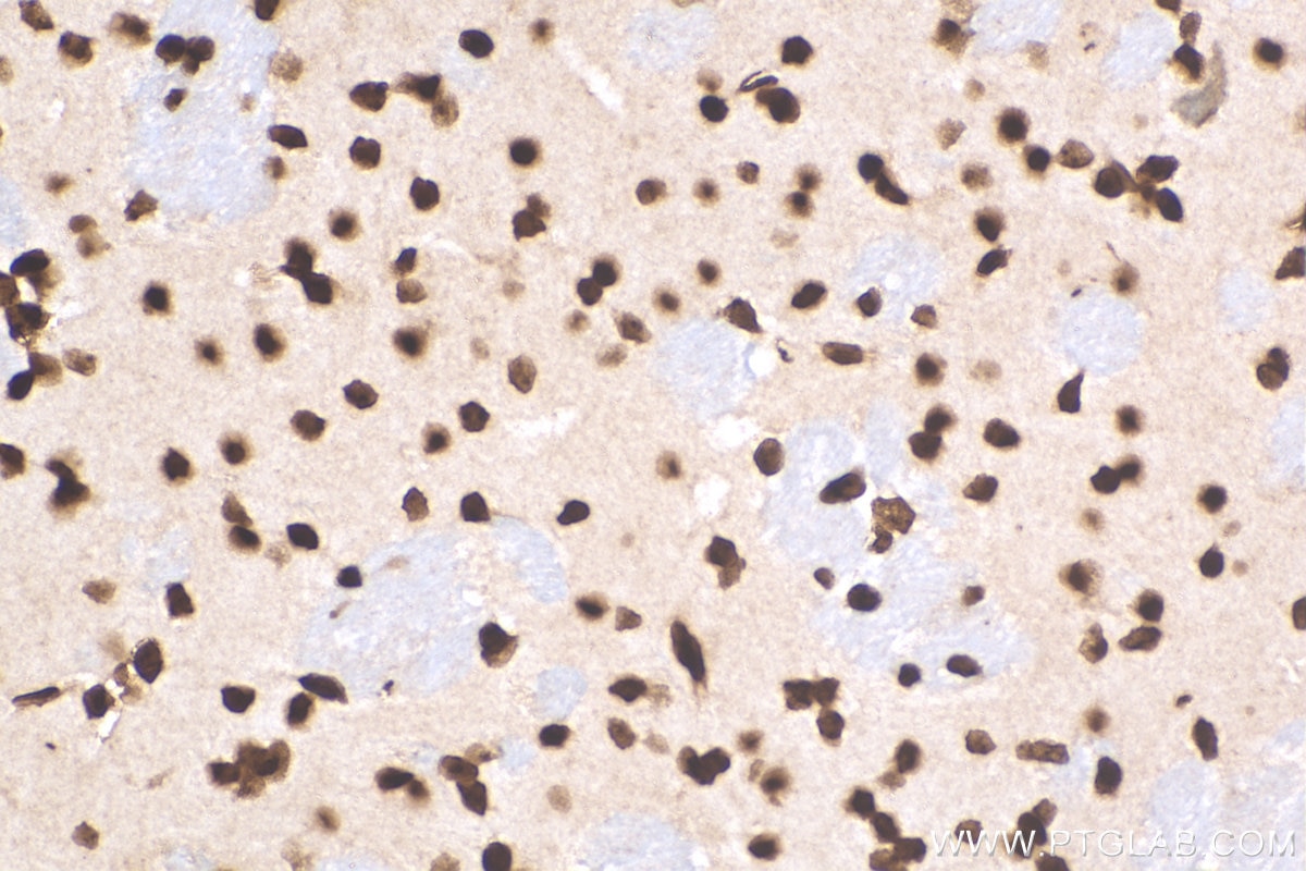 Immunohistochemistry (IHC) staining of mouse brain tissue using HIST1H1B Polyclonal antibody (18093-1-AP)