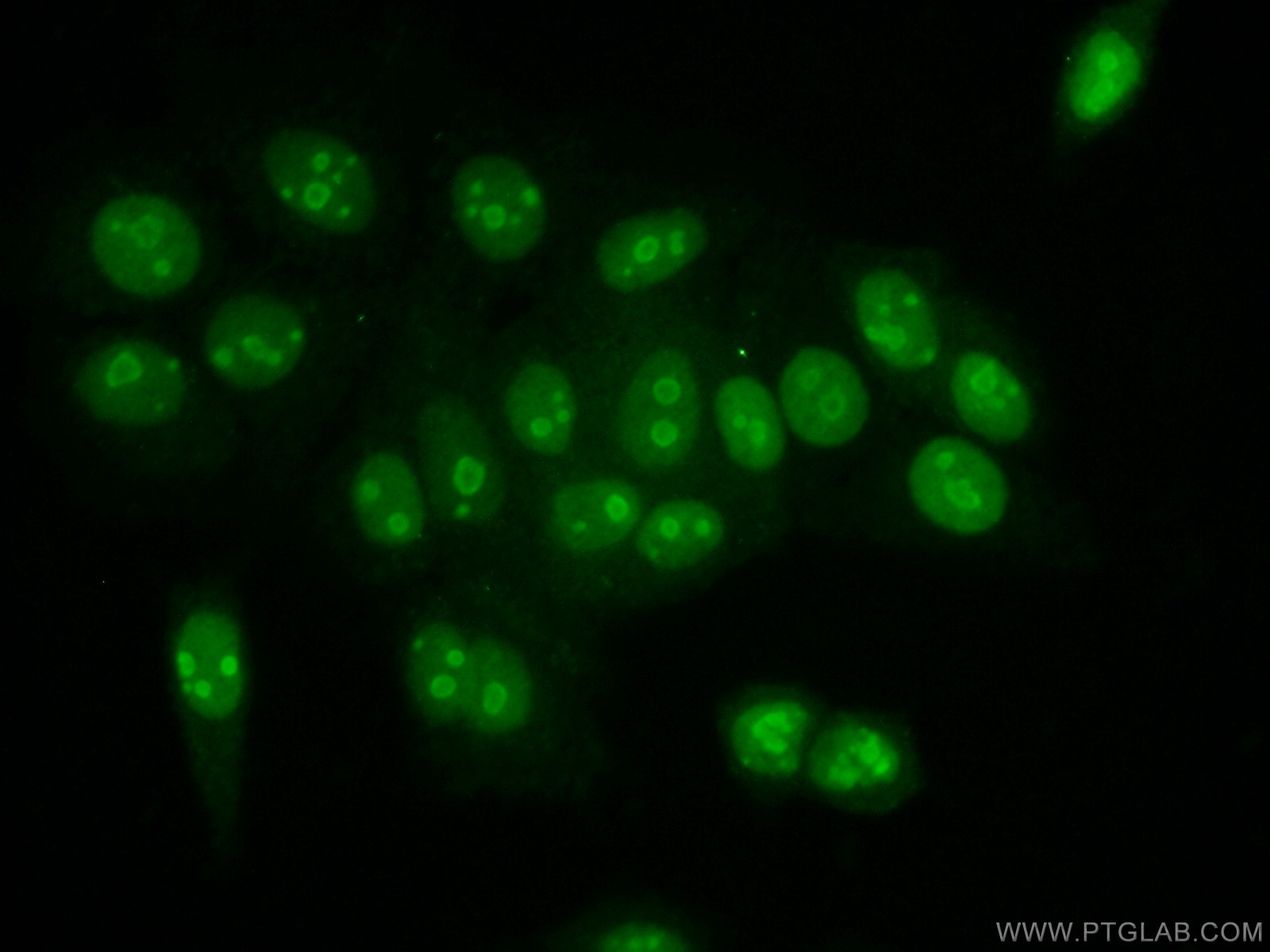 Immunofluorescence (IF) / fluorescent staining of MCF-7 cells using Histone H1.2 Polyclonal antibody (15446-1-AP)