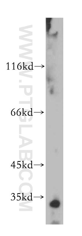 WB analysis of human testis using 15446-1-AP