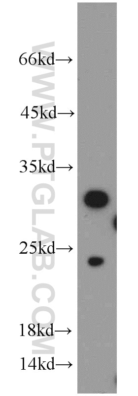 Western Blot (WB) analysis of Jurkat cells using Histone H1.2 Polyclonal antibody (15446-1-AP)