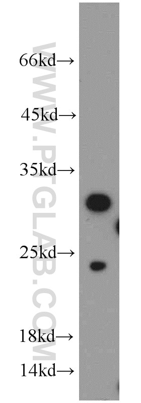 WB analysis of Jurkat using 15446-1-AP