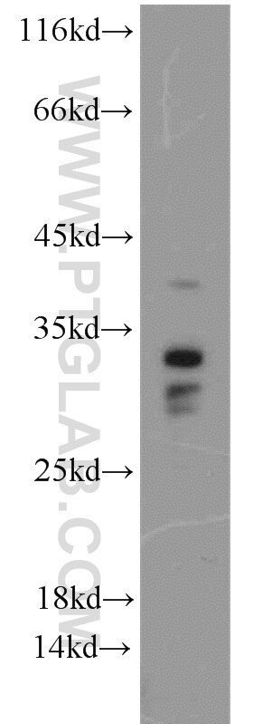 Western Blot (WB) analysis of MCF-7 cells using Histone H1.2 Polyclonal antibody (15446-1-AP)