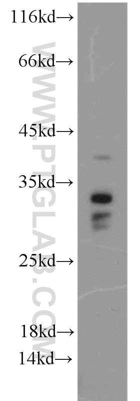 Western Blot (WB) analysis of MCF-7 cells using Histone H1.2 Polyclonal antibody (15446-1-AP)