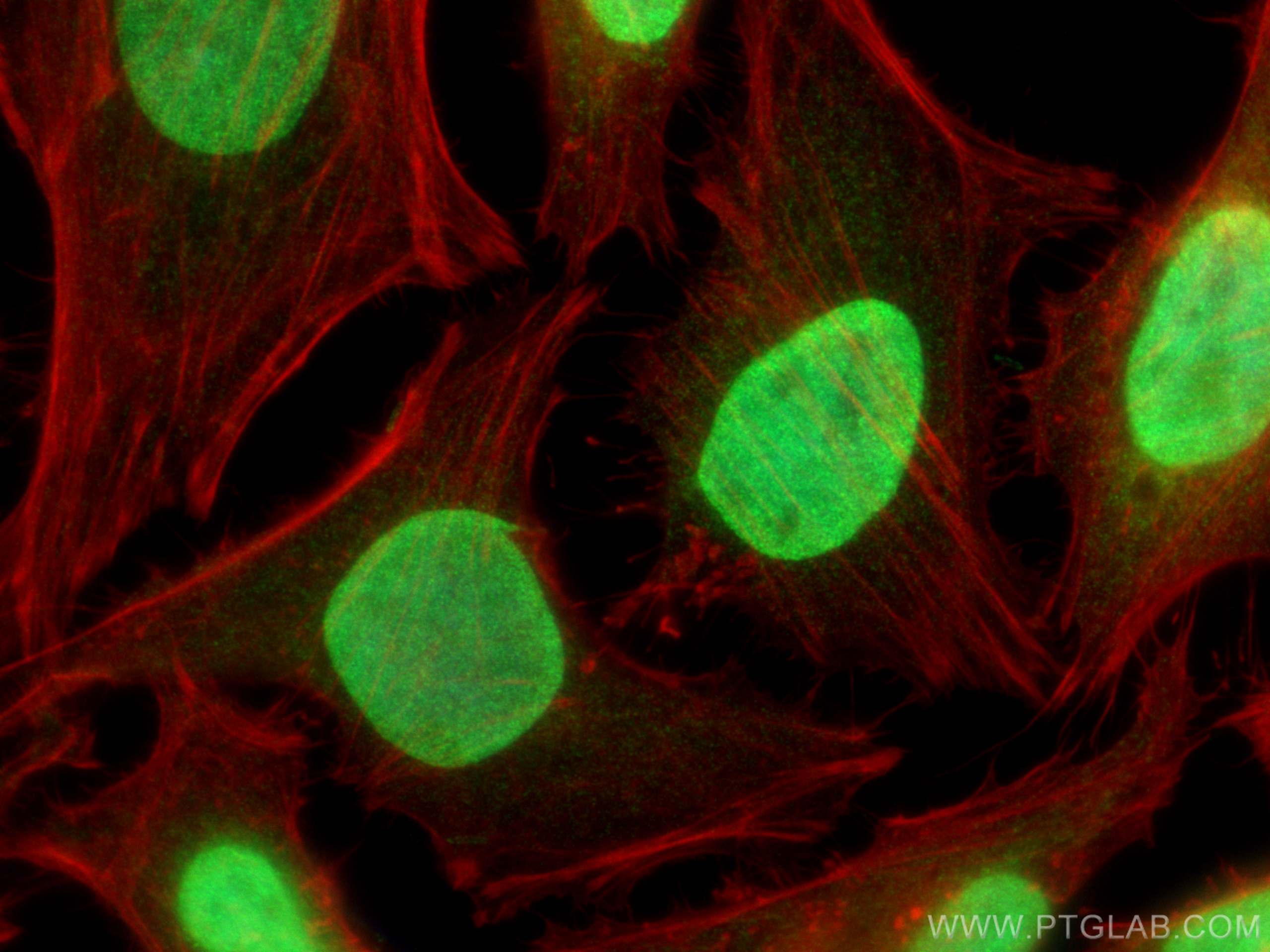 Immunofluorescence (IF) / fluorescent staining of HeLa cells using Histone H1.2 Polyclonal antibody (19649-1-AP)
