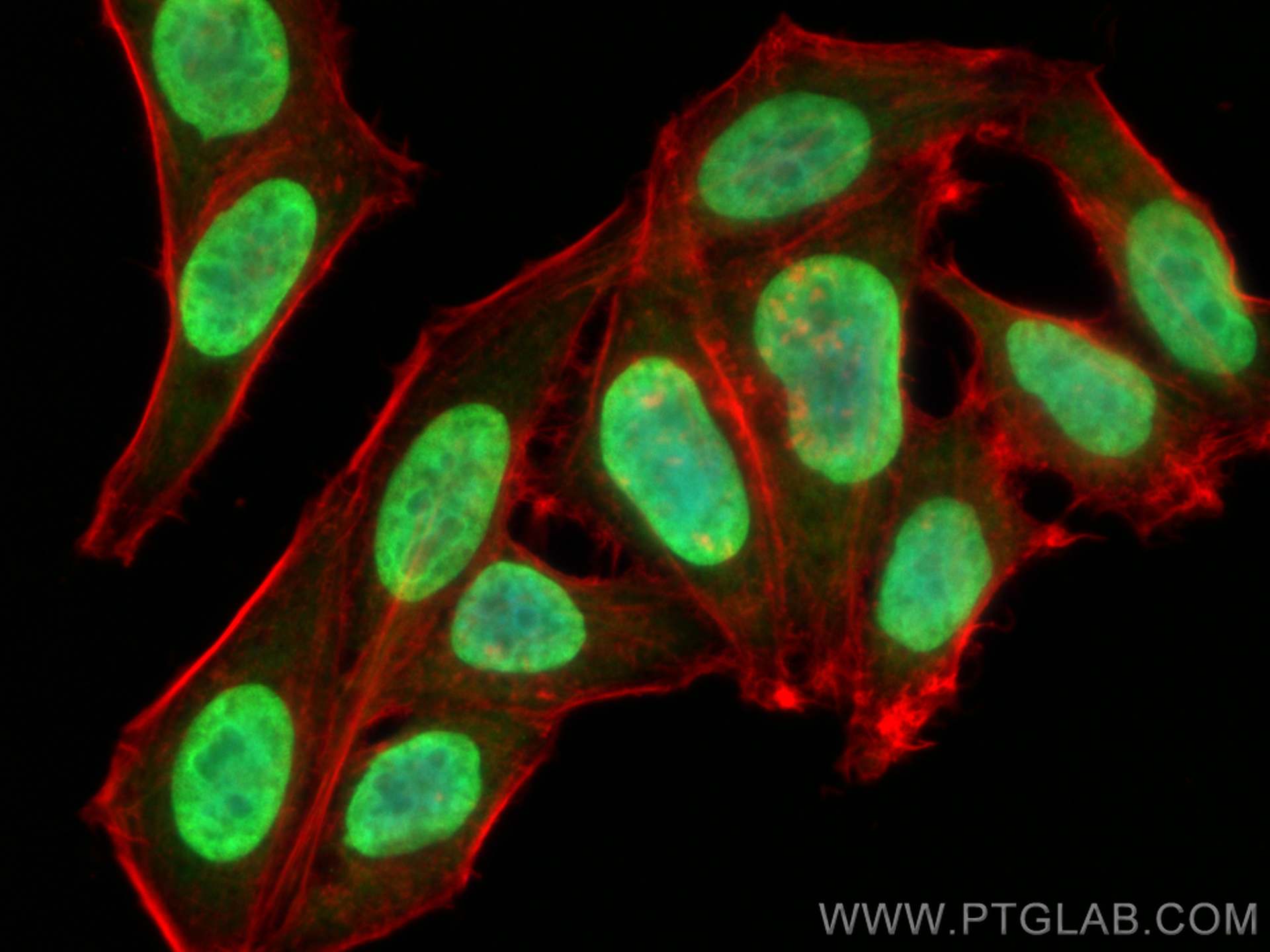 Immunofluorescence (IF) / fluorescent staining of HepG2 cells using Histone H1.2 Polyclonal antibody (19649-1-AP)