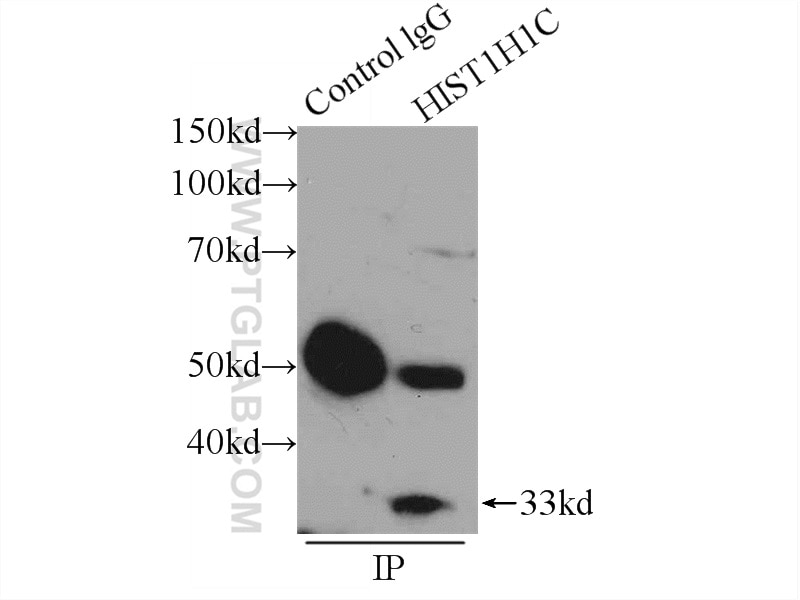 Immunoprecipitation (IP) experiment of HeLa cells using Histone H1.2 Polyclonal antibody (19649-1-AP)