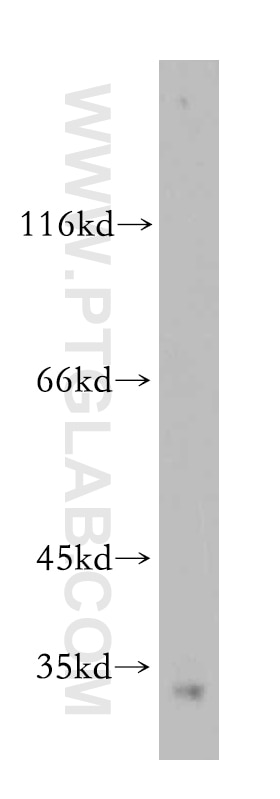 Western Blot (WB) analysis of human testis tissue using Histone H1.2 Polyclonal antibody (19649-1-AP)