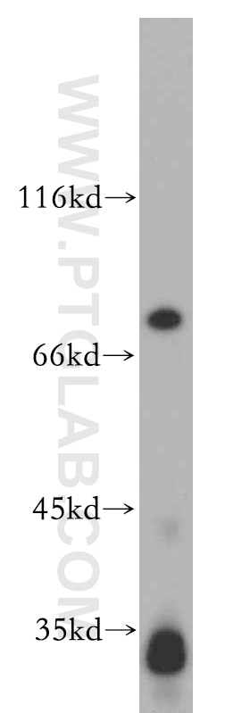 WB analysis of mouse thymus using 19649-1-AP