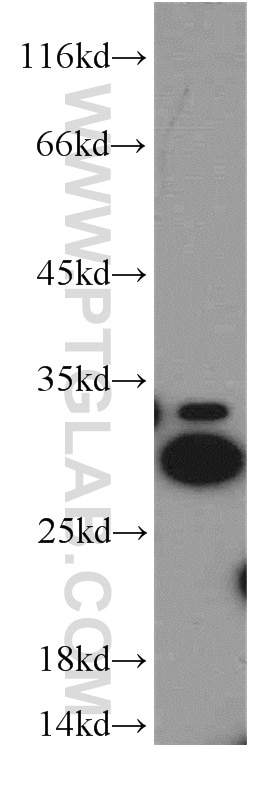 Western Blot (WB) analysis of Jurkat cells using Histone H1.2 Polyclonal antibody (19649-1-AP)