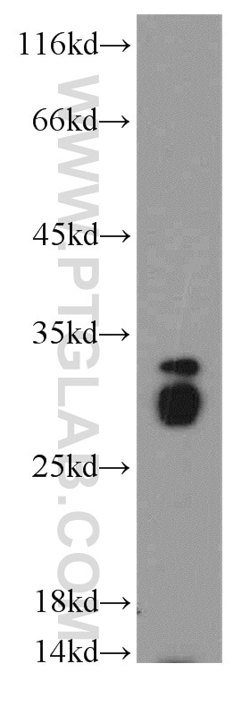 Western Blot (WB) analysis of MCF-7 cells using Histone H1.2 Polyclonal antibody (19649-1-AP)