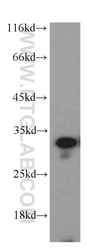 WB analysis of L02 using 19649-1-AP