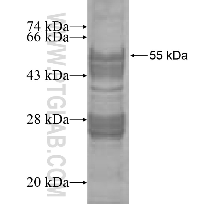 Histone H1.2 fusion protein Ag7607 SDS-PAGE