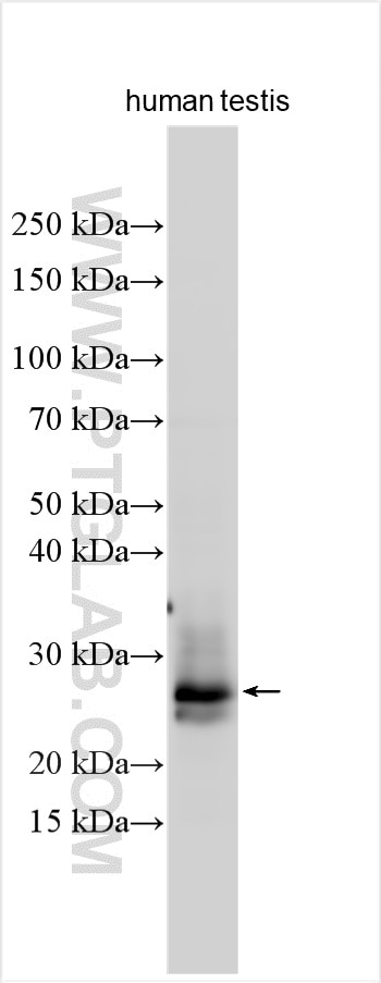 Western Blot (WB) analysis of various lysates using HIST1H1T Polyclonal antibody (18188-1-AP)