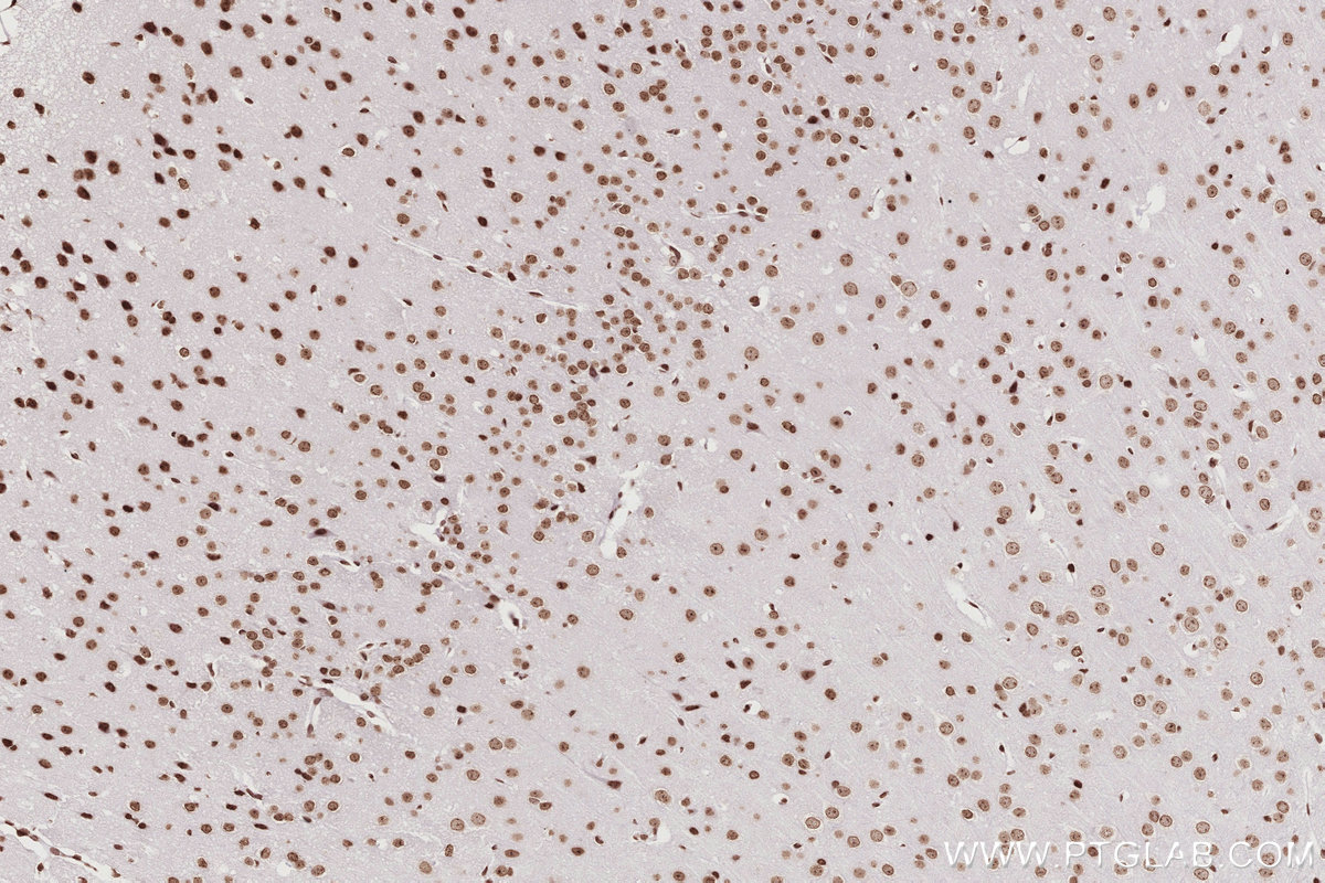 Immunohistochemistry (IHC) staining of mouse brain tissue using HIST1H2AC Polyclonal antibody (15953-1-AP)
