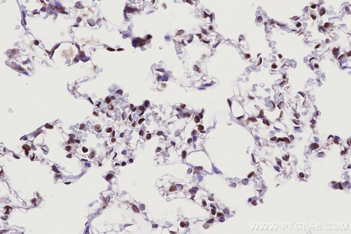 Immunohistochemistry (IHC) staining of rat lung tissue using HIST1H2AC Polyclonal antibody (15953-1-AP)
