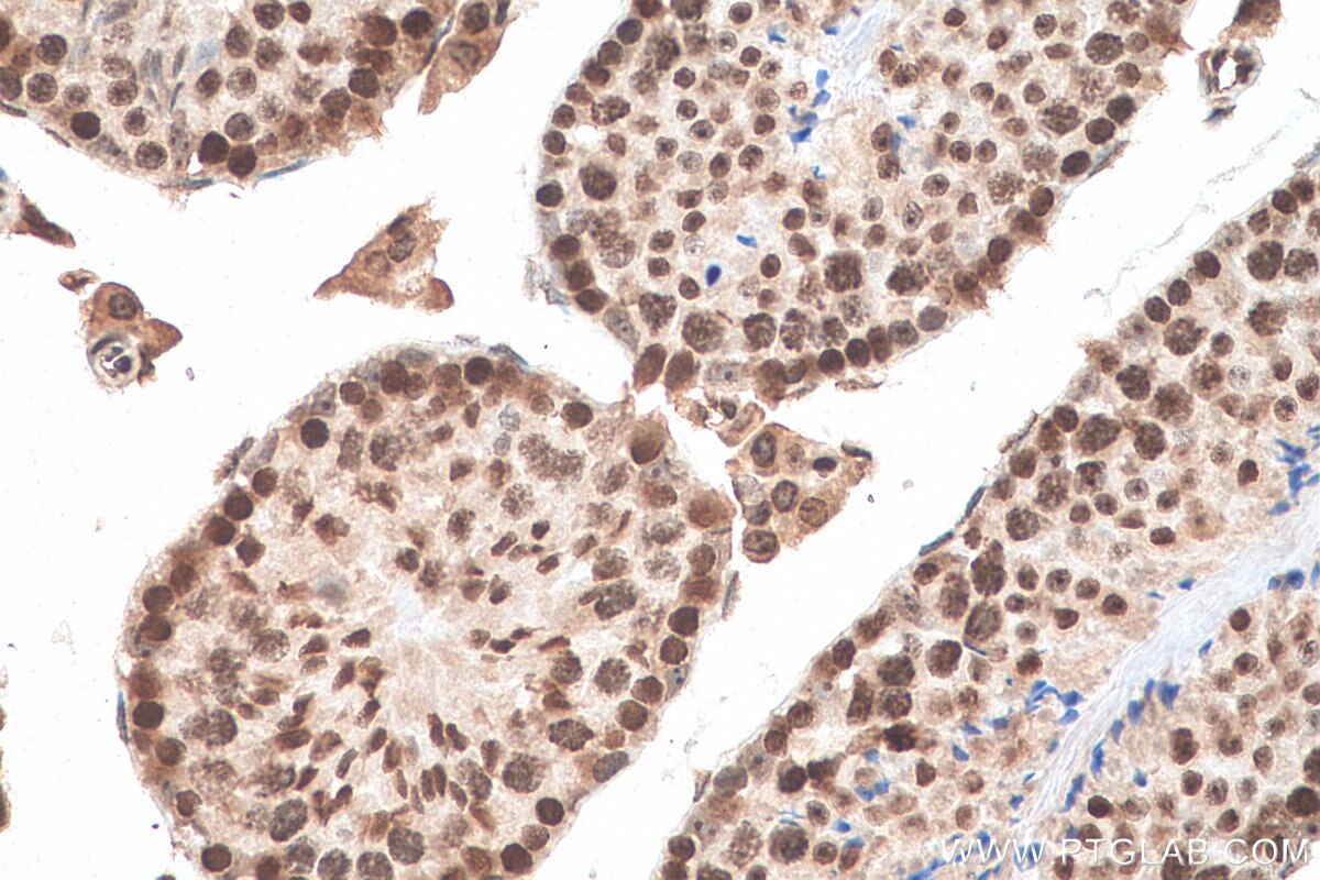 IHC staining of mouse testis using 68503-1-Ig