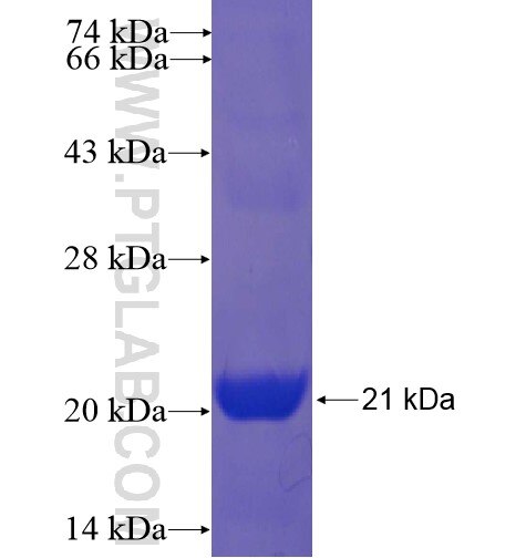 HIST1H3D fusion protein Ag15151 SDS-PAGE