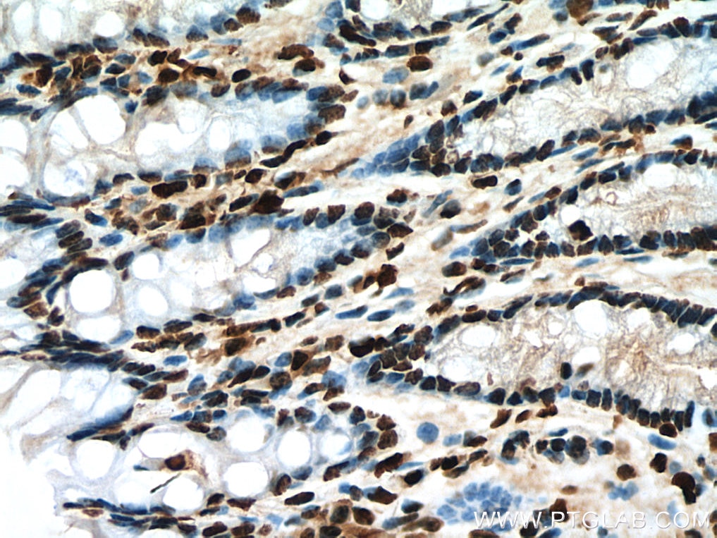 Immunohistochemistry (IHC) staining of mouse colon tissue using Histone H4 Polyclonal antibody (16047-1-AP)