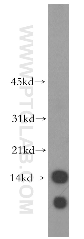 WB analysis of HeLa using 16047-1-AP