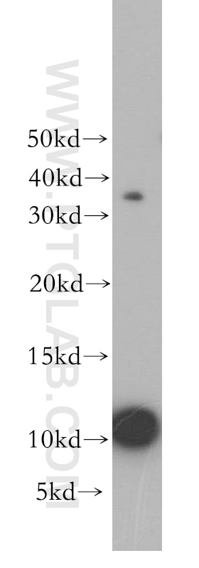 Western Blot (WB) analysis of human spleen tissue using HIST1H4F Polyclonal antibody (18341-1-AP)