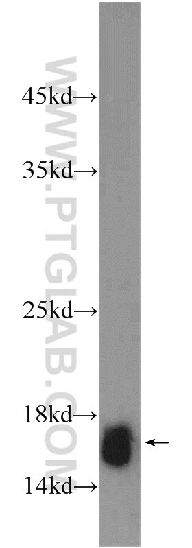 Western Blot (WB) analysis of rat liver tissue using HIST2H2AA4 Polyclonal antibody (15302-1-AP)